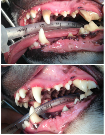 Dental cleaning before and after